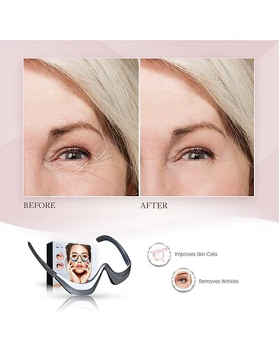 Anti-Aging Undereye EMS Device W/ Micro-Massage Women - Image 2