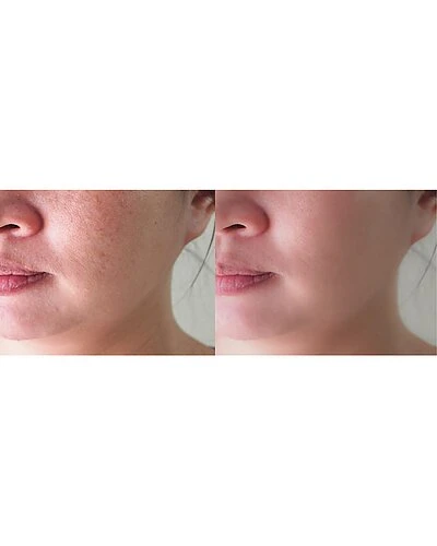 LED 11X Infrared Anti Aging Device Women - Image 6